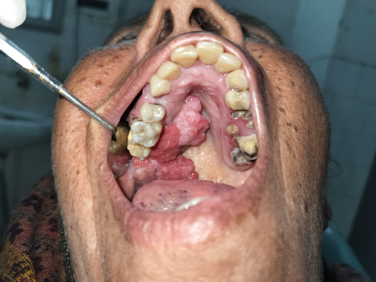Preoperative presentation