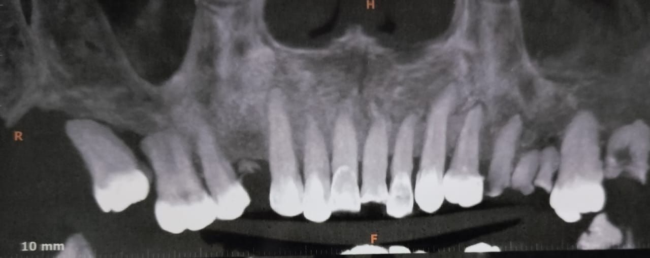 Radiologicalpresentation