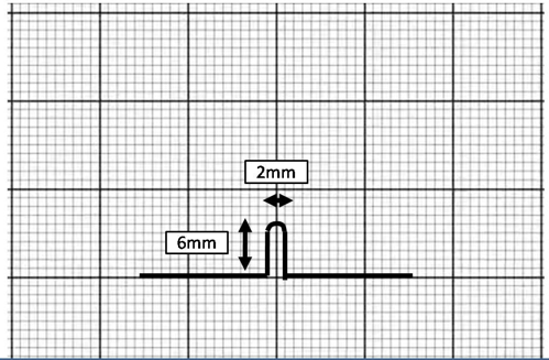 Dimensions of vertical loop
