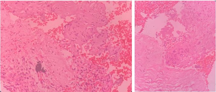Histopathological view