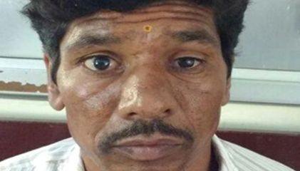 Poor cosmetic appearance because of Enophthalmos, Ptosis and Sulcus deformity
