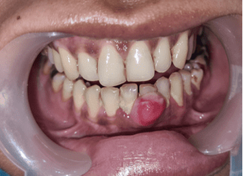 Pre-operative view