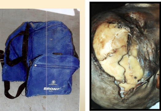 Bag and skull