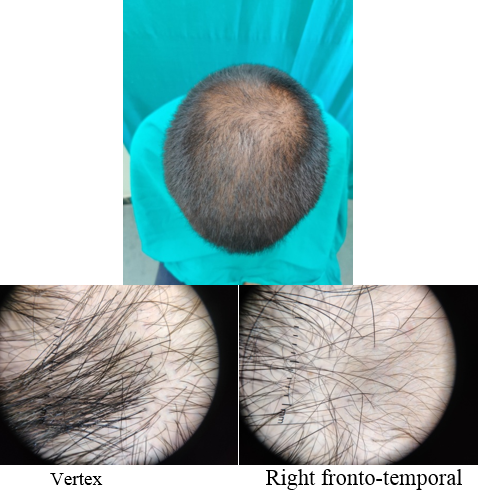 Group PRP: Patient 1: Initial Picture.