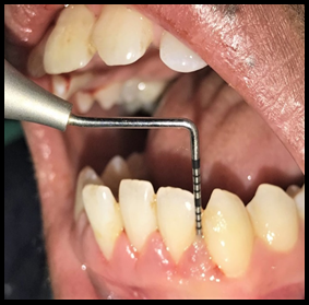 Baseline measurement 