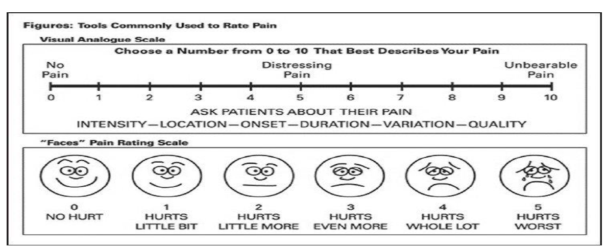Visual analogue scale