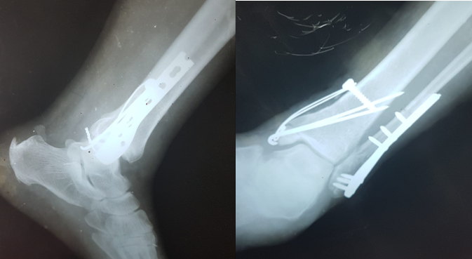1 month follow up 