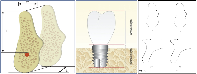 Bone Factors