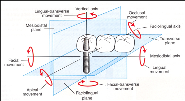 Clinical moment arms