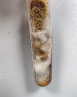 Culture tube showing mixed growth of Rhizopus arrizhus and Aspergillus flavus