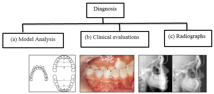 Diagnostic methods for maxillary transverse deficiency
