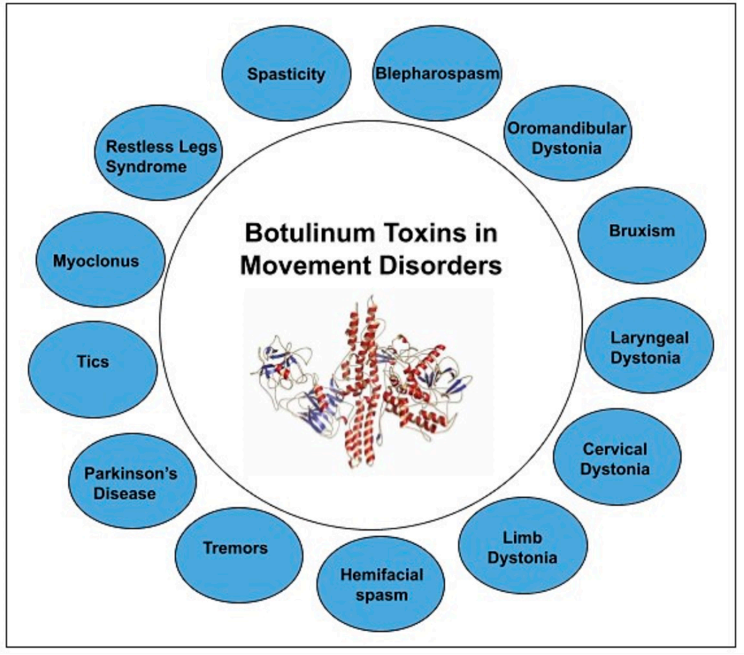 Botulin and movement disorders