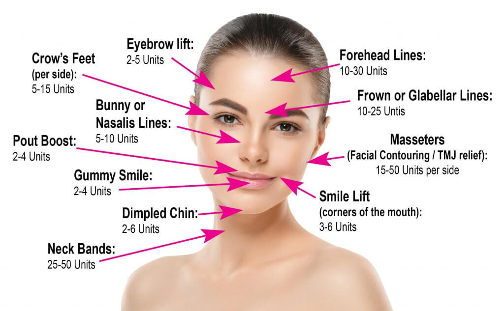 Site for botox injections