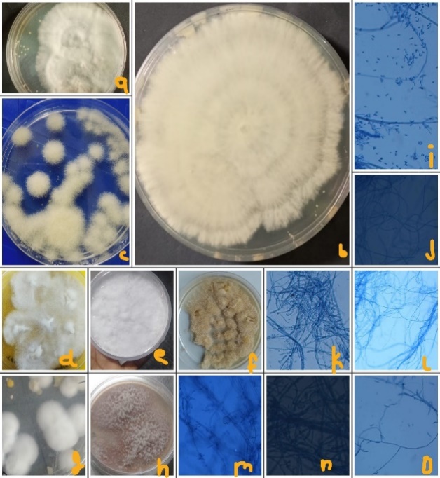 Mycosis collected from various heights of uttarakhand,here T.mentagrophyte (a ,b & m), T.rubrum (d,k-impart red pigment) collected From lower altitude in huge quantity remaining species Epidermophyto(f,j-turns straw colour) microsporum (c,o,h,i), Blastomycis (e,l) collected from higher altitudes in higher quantity.