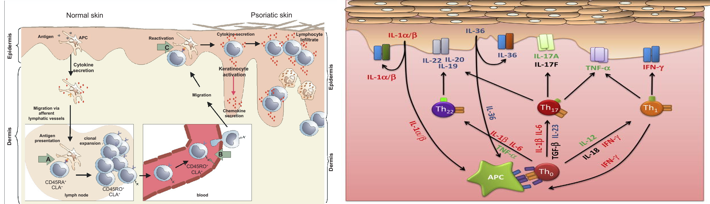 a: cellular changes in psoriasis b: Cellular intercepts