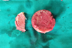 Bone slice