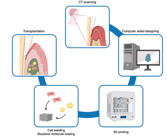 This workflow enables the creation of personalized 3D-printed scaffolds tailored to the unique requirements of each individual's periodontal defect, thereby enhancing the prospects for successful periodontal regeneration.