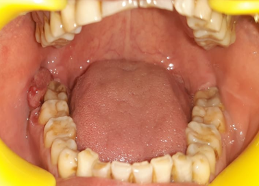 Hard tissue examination