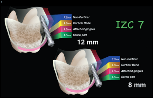 Length of the screw and its insertion depth into the bone.