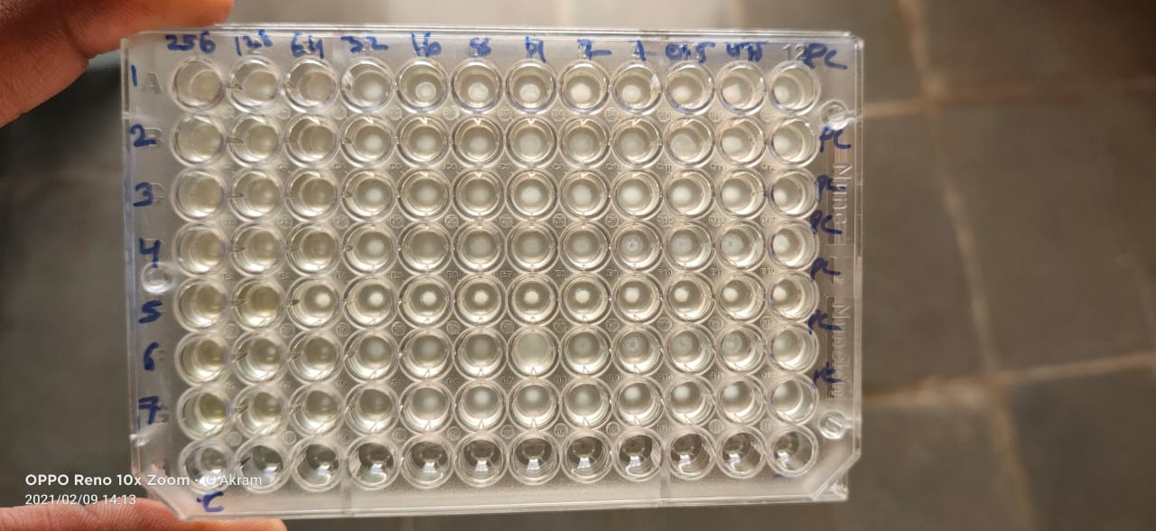 Test for detection of Minimum inhibitory concentration (MIC) of colistin