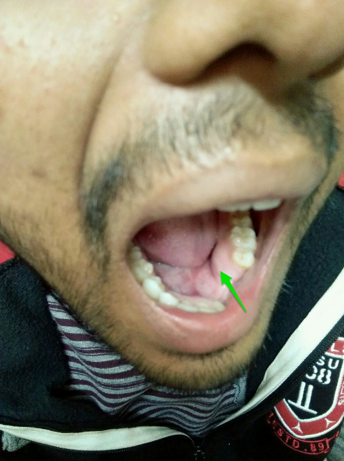 Clinical picture