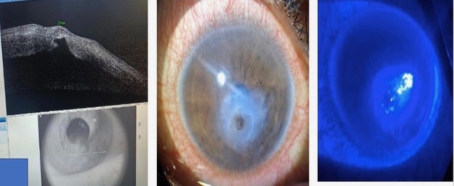 Showing preoperative work up