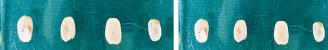 Cut samples after cavity filling with gic and cention-n on day 1