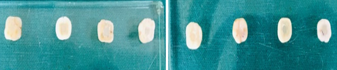 Cut samples after cavity filling with gic and cention-n on day 7