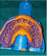 Conventional closed tray impression