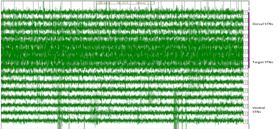 https://s3-us-west-2.amazonaws.com/typeset-prod-media-server/570b9d51-9d7f-4154-8e53-63161c042c1eimage43.png