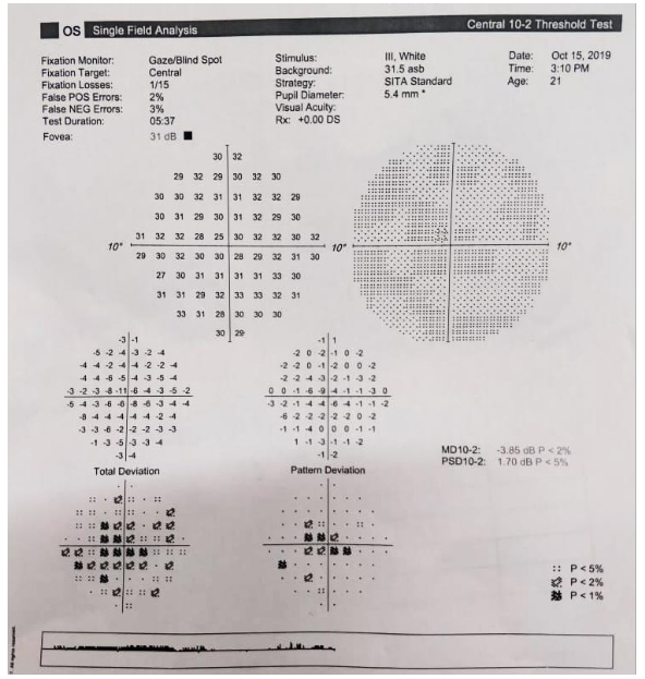 10 – 2 central threshold test of left eye at two months