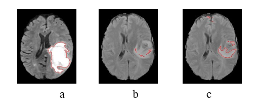 Example of sample and binary image from their best feature: (a) first image, second image with a bad (b) and good feature. (c)