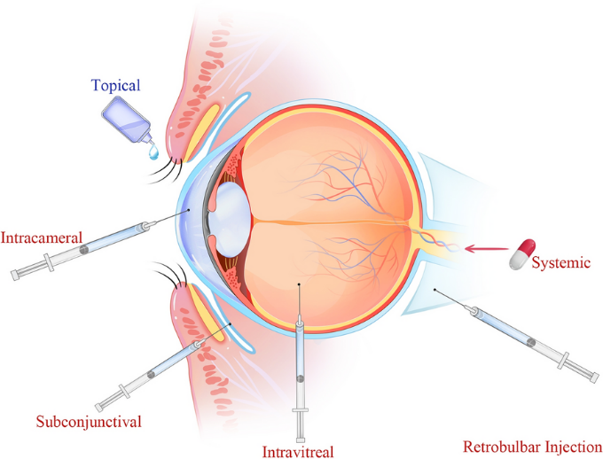 Routes of drug administration for ocular delivery