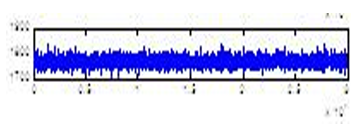 Microrecording of Sub stantia Nigra pc signal (MER with SNpc-DBS)