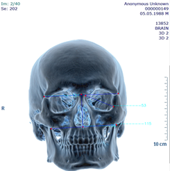 https://s3-us-west-2.amazonaws.com/typeset-prod-media-server/59fbe99c-77f3-447b-b34f-f977ac521629image1.png