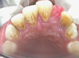 Palatal view 