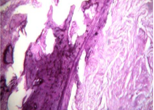 Histopathologic slide