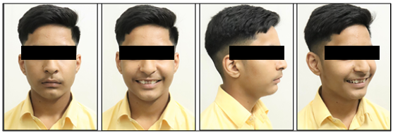 Pretreatment extratraoral photographs