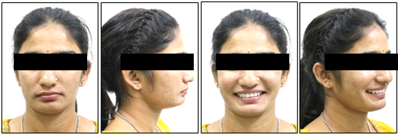 Post-treatment extraoral photographs