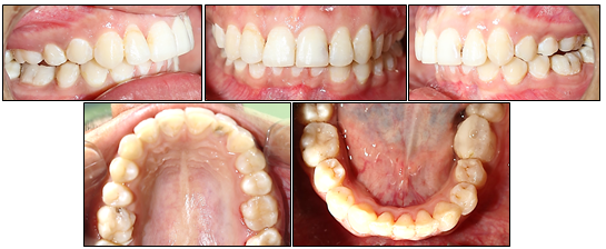 Post- treatment intraoral photographs