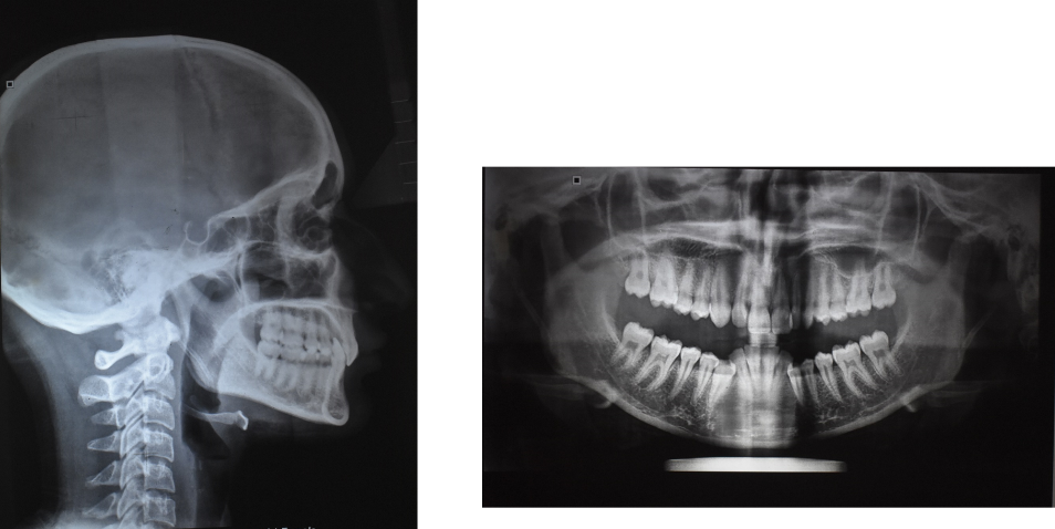 Pre-treatment radiographs