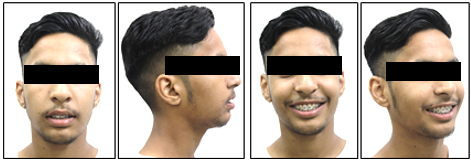 Posttreatment extraoral photographs