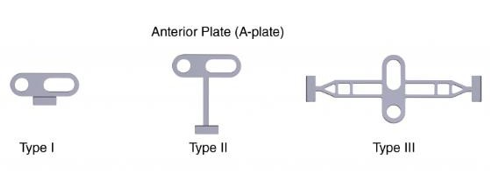 Various types of anterior CTOR plates