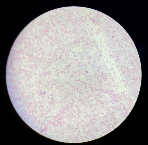 Chromobacterium Violaceum A Report Of Two Cases Of Septicaemia And Wound Infection Ijmmtd
