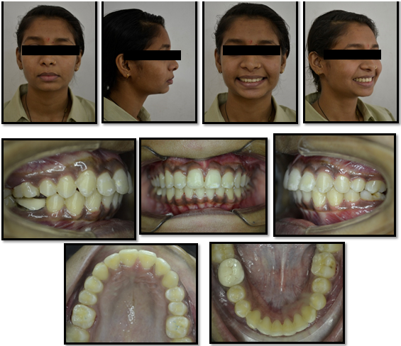 Post-treatment photographs