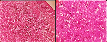 Histopathologic view, 10X, 40X magnification