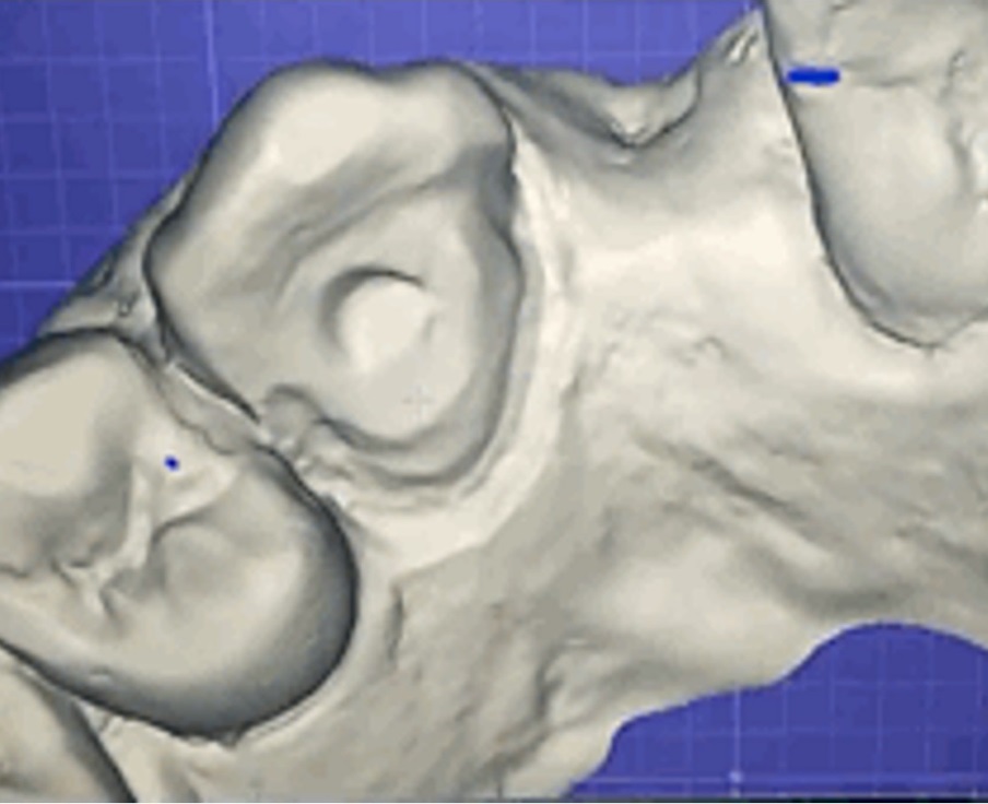 Tooth preparation view on CAD/CAM