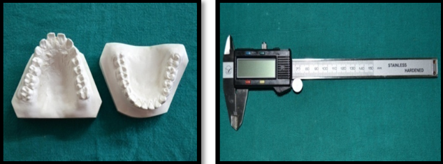 Digital caliper used for taking dental casts measurements