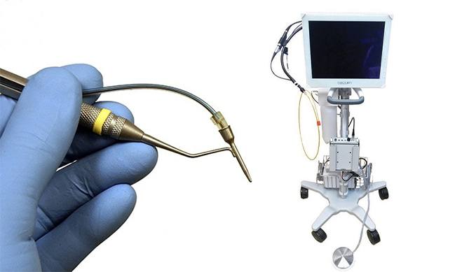 Perioscope