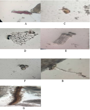 A: Lignified fibers, B: Covering trichome, C: Oil globules, D: Epidermal cells, E: Xylem vessels with spiral thickening, F: Pollen grains, G: Anther filament